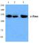 Colony Stimulating Factor 1 Receptor antibody, GTX34385, GeneTex, Western Blot image 