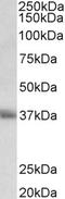 CD7 Molecule antibody, LS-C154912, Lifespan Biosciences, Western Blot image 