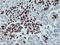 p53 antibody, LS-C172956, Lifespan Biosciences, Immunohistochemistry paraffin image 
