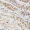 Beta-Transducin Repeat Containing E3 Ubiquitin Protein Ligase antibody, LS-C331612, Lifespan Biosciences, Immunohistochemistry paraffin image 