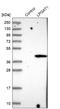 Lysophosphatidylglycerol Acyltransferase 1 antibody, HPA008304, Atlas Antibodies, Western Blot image 