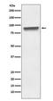 Mitochondrial inner membrane protein antibody, M04102, Boster Biological Technology, Western Blot image 