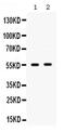 Solute Carrier Family 2 Member 9 antibody, PA5-80027, Invitrogen Antibodies, Western Blot image 