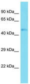 TATA-Box Binding Protein Associated Factor 7 Like antibody, TA329954, Origene, Western Blot image 