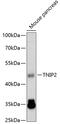 TNFAIP3 Interacting Protein 2 antibody, 19-509, ProSci, Western Blot image 