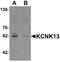 Potassium Two Pore Domain Channel Subfamily K Member 13 antibody, A14190, Boster Biological Technology, Western Blot image 