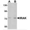 Interleukin 1 Receptor Associated Kinase 1 antibody, MBS150030, MyBioSource, Western Blot image 