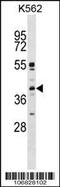 Mitogen-Activated Protein Kinase 11 antibody, 62-959, ProSci, Western Blot image 