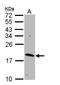 GTP-binding protein Rheb antibody, GTX108597, GeneTex, Western Blot image 