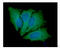 Janus Kinase 2 antibody, GTX57670, GeneTex, Immunofluorescence image 