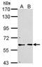 Cyclin Dependent Kinase 16 antibody, PA5-29418, Invitrogen Antibodies, Western Blot image 