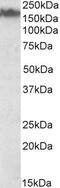 Neurofilament Medium antibody, PA5-19200, Invitrogen Antibodies, Western Blot image 