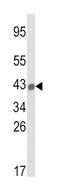 HLA class I histocompatibility antigen, B-27 alpha chain antibody, abx034028, Abbexa, Flow Cytometry image 