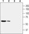 Solute Carrier Family 28 Member 2 antibody, PA5-77547, Invitrogen Antibodies, Western Blot image 