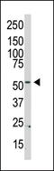 Phosphatidylinositol 4-Kinase Type 2 Beta antibody, LS-C101107, Lifespan Biosciences, Western Blot image 