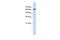 Eukaryotic Translation Initiation Factor 2D antibody, GTX47335, GeneTex, Western Blot image 