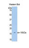 Aggrecan antibody, LS-C292674, Lifespan Biosciences, Western Blot image 