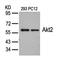 AKT Serine/Threonine Kinase 2 antibody, orb14554, Biorbyt, Western Blot image 