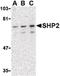 Protein Tyrosine Phosphatase Non-Receptor Type 11 antibody, LS-B1391, Lifespan Biosciences, Western Blot image 