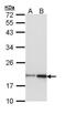 NME/NM23 Nucleoside Diphosphate Kinase 1 antibody, PA5-29612, Invitrogen Antibodies, Western Blot image 