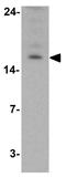 Late Endosomal/Lysosomal Adaptor, MAPK And MTOR Activator 2 antibody, GTX32131, GeneTex, Western Blot image 