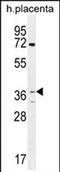 Olfactory Receptor Family 2 Subfamily AT Member 4 antibody, PA5-71599, Invitrogen Antibodies, Western Blot image 