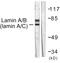 Lamin A/C antibody, LS-C117663, Lifespan Biosciences, Western Blot image 