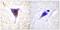 Mechanistic Target Of Rapamycin Kinase antibody, PA5-38374, Invitrogen Antibodies, Immunohistochemistry frozen image 