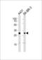 Cyclin Dependent Kinase 1 antibody, MBS9210466, MyBioSource, Western Blot image 