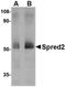 Sprouty Related EVH1 Domain Containing 2 antibody, orb75080, Biorbyt, Western Blot image 