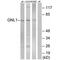 G Protein Nucleolar 1 (Putative) antibody, PA5-50044, Invitrogen Antibodies, Western Blot image 