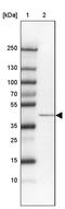 Saccharopine Dehydrogenase (Putative) antibody, PA5-62239, Invitrogen Antibodies, Western Blot image 