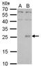 Cytokine Receptor Like Factor 1 antibody, NBP2-19580, Novus Biologicals, Western Blot image 