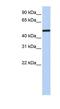 Nuclear Receptor Subfamily 2 Group F Member 1 antibody, NBP1-52825, Novus Biologicals, Western Blot image 