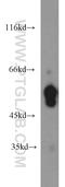Calcium/Calmodulin Dependent Protein Kinase II Beta antibody, 55218-1-AP, Proteintech Group, Western Blot image 