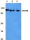Apolipoprotein B Receptor antibody, A09242, Boster Biological Technology, Western Blot image 
