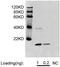 Colony Stimulating Factor 2 antibody, LS-C203107, Lifespan Biosciences, Western Blot image 