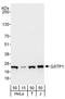 Glutathione S-transferase P 1 antibody, A303-628A, Bethyl Labs, Western Blot image 
