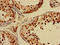 CAMP Responsive Element Binding Protein 3 Like 4 antibody, LS-C677598, Lifespan Biosciences, Immunohistochemistry paraffin image 