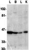 DNA Fragmentation Factor Subunit Alpha antibody, GTX31639, GeneTex, Western Blot image 