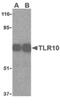 Toll-like receptor 10 antibody, PA5-20054, Invitrogen Antibodies, Western Blot image 