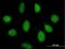 Microtubule Associated Scaffold Protein 2 antibody, H00023281-B01P, Novus Biologicals, Immunofluorescence image 