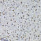 Protein Phosphatase 1 Regulatory Subunit 8 antibody, 22-418, ProSci, Immunohistochemistry paraffin image 