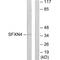 Sideroflexin 4 antibody, A12029, Boster Biological Technology, Western Blot image 