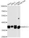 Aldo-Keto Reductase Family 1 Member C1 antibody, A13004, ABclonal Technology, Western Blot image 