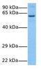 TBC1 Domain Family Member 24 antibody, GTX44910, GeneTex, Western Blot image 