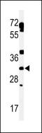 TBC1 Domain Family Member 7 antibody, 64-177, ProSci, Western Blot image 