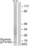 Baculoviral IAP Repeat Containing 5 antibody, LS-C199621, Lifespan Biosciences, Western Blot image 