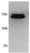 DNA Methyltransferase 3 Beta antibody, NB300-516, Novus Biologicals, Western Blot image 