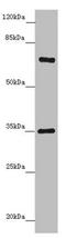Zinc Finger Protein 169 antibody, LS-C676745, Lifespan Biosciences, Western Blot image 